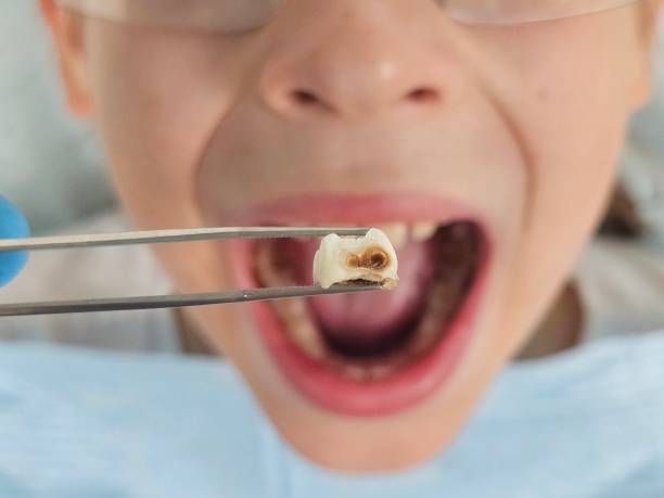 Best Emergency Dental Care for Sports Injuries in Kenwood Estates, FL